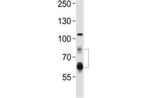 Western blot analysis of lysate from HeLa cell line using PCSK9 antibody. (PCSK9 antibody  (AA 144-173))
