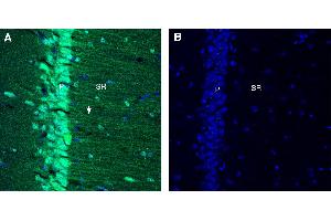 Free-floating frozen brain sections from a paraformaldehyde-perfused mouse were incubated with Anti-GlyT1 (SLC6A9) (extracellular) Antibody (ABIN7043261, 1:300), followed by goat anti-rabbit secondary antibody conjugated to Alexa Fluor® 488 (green).