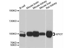 Western blot analysis of extracts of various cell lines, using XPOT antibody (ABIN6292909) at 1:3000 dilution. (XPOT antibody)