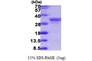 SDS-PAGE (SDS) image for SGT1, Suppressor of G2 Allele of SKP1 (SUGT1) (AA 115-365) protein (His tag) (ABIN667341) (SUGT1 Protein (AA 115-365) (His tag))