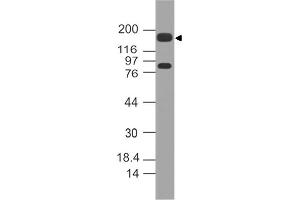 Image no. 1 for anti-Mucin 4, Cell Surface Associated (MUC4) (AA 1700-1960) antibody (ABIN5027373) (MUC4 antibody  (AA 1700-1960))