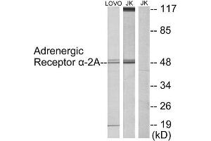 Western Blotting (WB) image for anti-Alpha-2A Adrenergic Receptor (ADRA2A) (C-Term) antibody (ABIN1849124)