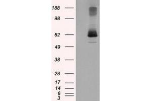 HEK293T cells were transfected with the pCMV6-ENTRY control (Left lane) or pCMV6-ENTRY LIPG (Right lane) cDNA for 48 hrs and lysed. (LIPG antibody)