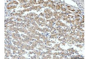 IHC analysis of ALDH3A1 using anti-ALDH3A1 antibody (ABIN7601680). (ALDH3A1 antibody  (AA 413-453))