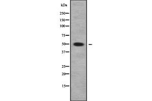Western blot analysis of PLA1A using HeLa whole cell lysates (PLA1A antibody  (Internal Region))