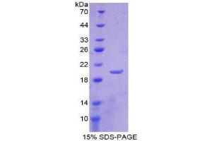 SDS-PAGE (SDS) image for Lipocalin 1 (LCN1) (AA 24-172) protein (His tag) (ABIN1980988) (Lipocalin 1 Protein (LCN1) (AA 24-172) (His tag))
