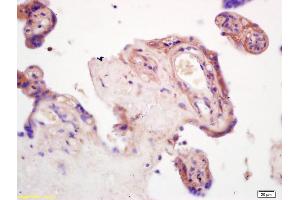 Formalin-fixed and paraffin embedded rat brain tissue labeled with Anti--GDF15/MIC-1 Polyclonal Antibody, Unconjugated (ABIN704561) at 1:200, followed by conjugation to the secondary antibody and DAB staining (GDF15 antibody  (AA 221-308))