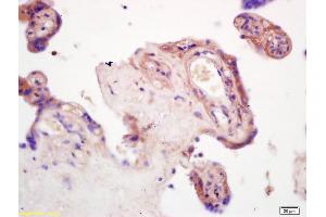 Formalin-fixed and paraffin embedded rat brain tissue labeled with Anti--GDF15/MIC-1 Polyclonal Antibody, Unconjugated (ABIN704561) at 1:200, followed by conjugation to the secondary antibody and DAB staining