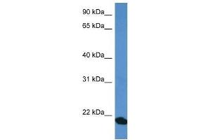 Western Blot showing COMMD1 antibody used at a concentration of 1 ug/ml against Fetal Heart Lysate (COMMD1 antibody  (C-Term))