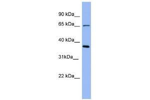 Uromodulin antibody used at 1 ug/ml to detect target protein. (Uromodulin antibody  (Middle Region))