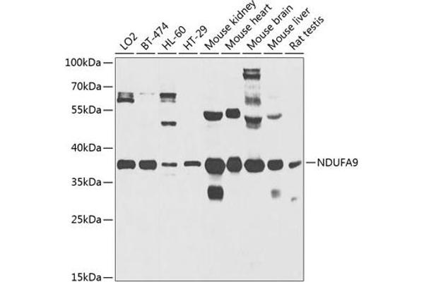 NDUFA9 antibody  (AA 1-270)
