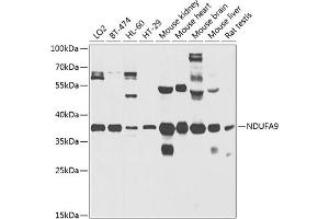 Western blot analysis of extracts of various cell lines, using NDUF antibody (ABIN3017566, ABIN3017567, ABIN5664241 and ABIN6220158) at 1:1000 dilution. (NDUFA9 antibody  (AA 1-270))
