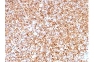 Formalin-fixed, paraffin-embedded human Tonsil stained with HLA- Pan Mouse Monoclonal Antibody (CR3/43). (MHC Class II HLA-DP/DQ/DR antibody)