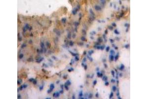 IHC-P analysis of Lung tissue, with DAB staining. (SEMA3E antibody  (AA 581-669))