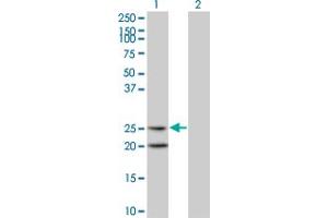 Western Blot analysis of IL6 expression in transfected 293T cell line by IL6 monoclonal antibody (M06), clone 4H5. (IL-6 antibody  (AA 29-212))