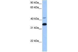 GNB2 antibody used at 1 ug/ml to detect target protein. (GNB2 antibody)