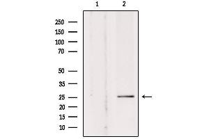 Western blot analysis of extracts from rat brain, using SOD-3  Antibody. (SOD3 antibody  (Internal Region))