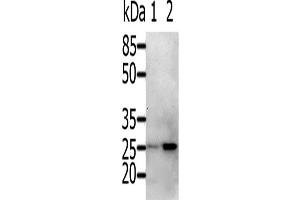 Western Blotting (WB) image for anti-RAB5A, Member RAS Oncogene Family (RAB5A) antibody (ABIN2425529) (RAB5 antibody)