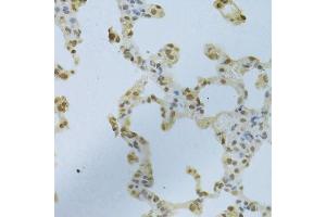 Immunohistochemistry (Paraffin-embedded Sections) (IHC (p)) image for anti-Heterogeneous Nuclear Ribonucleoprotein K (HNRNPK) (AA 1-280) antibody (ABIN3022414)