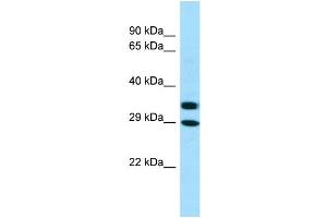 WB Suggested Anti-AKR1A1 Antibody Titration: 1. (AKR1A1 antibody  (C-Term))