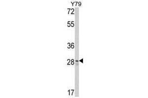 Image no. 1 for anti-CUE Domain Containing 2 (CUEDC2) (C-Term) antibody (ABIN452895) (CUEDC2 antibody  (C-Term))