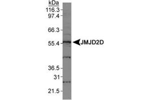 Western blot analysis of JMJD2D in HeLa nuclear extracts using JMJD2D polyclonal antibody . (JMJD2D antibody  (AA 460-520))