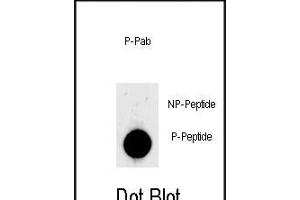 Dot blot analysis of anti-Phospho-LIN28- Phospho-specific Pab (ABIN650868 and ABIN2839816) on nitrocellulose membrane. (LIN28A antibody  (pSer134))