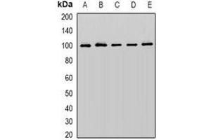 Western blot analysis of Cullin 5 expression in K562 (A), PC3 (B), SW480 (C), mouse brain (D), mouse heart (E) whole cell lysates. (Cullin 5 antibody)