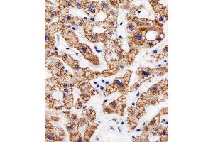 Immunohistochemistry (Paraffin-embedded Sections) (IHC (p)) image for anti-ArfGAP with GTPase Domain, Ankyrin Repeat and PH Domain 4 (AGAP4) (AA 498-531), (C-Term) antibody (ABIN1944739)