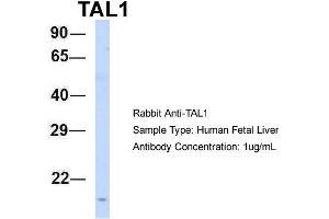 Host: Rabbit Target Name: TAL1 Sample Type: Human Fetal Liver Antibody Dilution: 1. (TAL1 antibody  (N-Term))