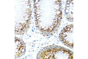 Immunohistochemistry of paraffin-embedded human colon using CCL2 antibody at dilution of 1:100 (40x lens). (CCL2 antibody)