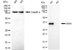 anti-Survival of Motor Neuron 1, Telomeric (SMN1) antibody