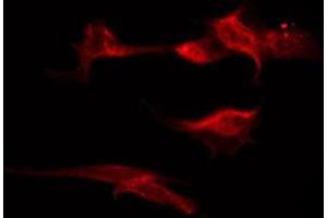 ABIN6274957 staining MCF7 by IF/ICC. (CA12 antibody  (N-Term))