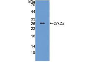 Figure. (ICA1 antibody  (AA 1-258))