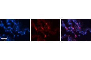 Rabbit Anti-HLA-F Antibody     Formalin Fixed Paraffin Embedded Tissue: Human Lung Tissue  Observed Staining: Membrane and cytoplasmic in alveolar type I cells  Primary Antibody Concentration: 1:100  Secondary Antibody: Donkey anti-Rabbit-Cy3  Secondary Antibody Concentration: 1:200  Magnification: 20X  Exposure Time: 0.