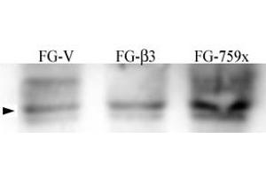 FG Pancreatic Carcinoma Cell stably expressing vector along (FG-V) the b3 integrin subunit (FG-b3) or a b3 truncation mutant (FG-759x). (Src antibody  (pTyr215))