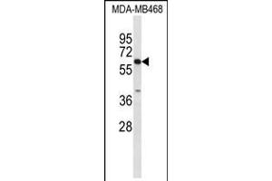 Western blot analysis of CES7 Antibody in MDA-MB468 cell line lysates (35ug/lane)