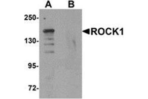 Western blot analysis of ROCK1 in 293 cell lysate with ROCK1 antibody at 1 μg/ml in (A) the absence and (B) the presence of blocking peptide. (ROCK1 antibody  (N-Term))