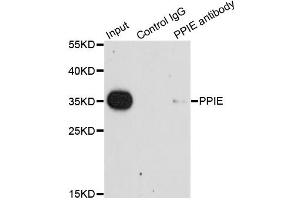 Immunoprecipitation analysis of 200 μg extracts of HeLa cells using 1 μg PPIE antibody (ABIN5975469). (PPIE antibody)