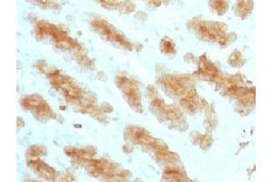 Formalin paraffin rat stomach with Acidic Cytokeratin antibody (KRTL/1077). (Keratin Acidic (AE1) antibody)