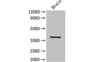 Western Blot Positive WB detected in: Mouse brain tissue All lanes: IL12B antibody at 4 μg/mL Secondary Goat polyclonal to rabbit IgG at 1/50000 dilution Predicted band size: 38 kDa Observed band size: 38 kDa (IL12B antibody  (AA 23-328))