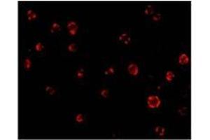 Immunofluorescence of AES in Hela cells with AES antibody at 20 µg/ml (AES antibody  (C-Term, N-Term))