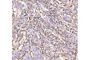 IHC analysis of Epac1/RAPGEF3 using anti-Epac1/RAPGEF3 antibody (ABIN7601858). (RAPGEF3 antibody  (AA 49-881))