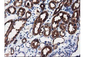 Immunohistochemical staining of paraffin-embedded Human liver tissue using anti-ALDH1L1 mouse monoclonal antibody. (ALDH1L1 antibody)