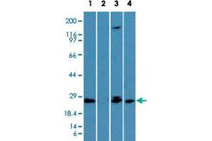 Western blot analysis of TICAM2 in the (Lane 1) absence and (Lane 2) presence of immunizing peptide in human lung, (Lane 3) mouse lung and (Lane 4) rat lung lysate using TICAM2 polyclonal antibody  at 1 ug/mL .