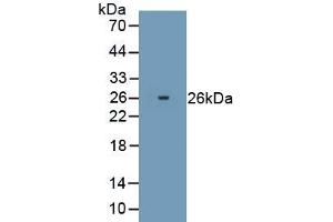 Detection of Recombinant PRDX2, Human using Polyclonal Antibody to Peroxiredoxin 2 (PRDX2) (Peroxiredoxin 2 antibody  (AA 2-198))