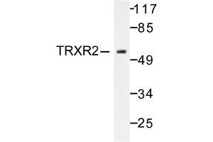Image no. 1 for anti-Thioredoxin Reductase 2 (TXNRD2) antibody (ABIN271967) (TXNRD2 antibody)