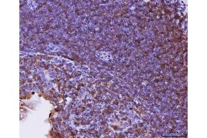 IHC analysis of Cxcr3 using anti-Cxcr3 antibody (ABIN7599273). (CXCR3 antibody  (AA 1-326))