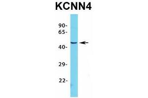 Host:  Rabbit  Target Name:  KCNN4  Sample Type:  HepG2  Antibody Dilution:  1. (KCNN4 antibody  (C-Term))