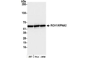 Western Blotting (WB) image for anti-Importin Subunit alpha-1 (KPNA2) (C-Term) antibody (ABIN7453571) (Importin Subunit alpha-1 (KPNA2) (C-Term) antibody)